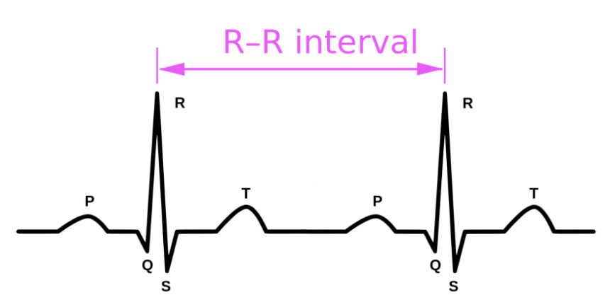 R-R interval je doba mezi dvěma údery srdce.